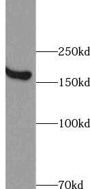 ABCA8 Antibody - BSA Free