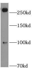 ABCA2 Antibody - BSA Free