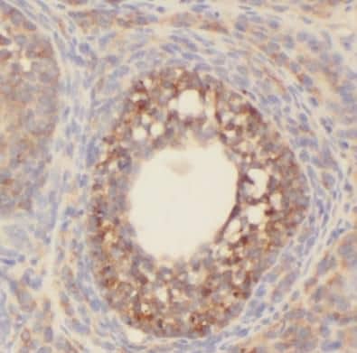 Serotonin N-acetyltransferase Antibody - BSA Free