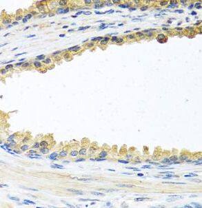 Cochlin Antibody - BSA Free