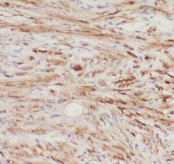 eIF4EBP2 Antibody - BSA Free