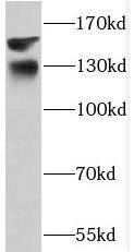 PHKA1 Antibody - BSA Free