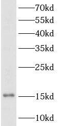 TSH beta Antibody - BSA Free