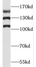 RAB3GAP2 Antibody - BSA Free