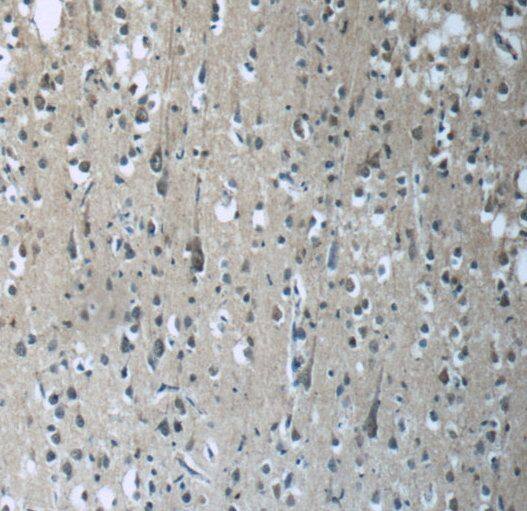 RAB3GAP2 Antibody - BSA Free