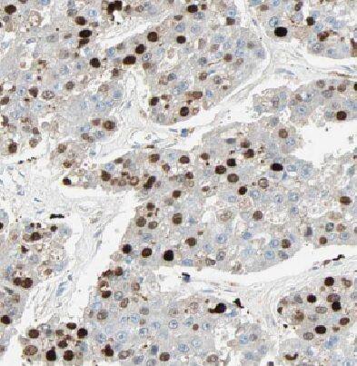 HIST1H2BD Antibody - BSA Free