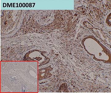 PSCA Antibody (DM87)