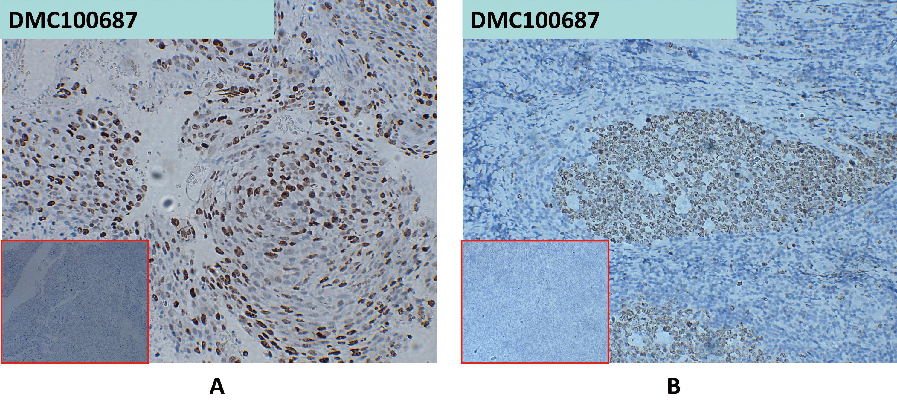 CXADR Antibody (DMC687) - Chimeric