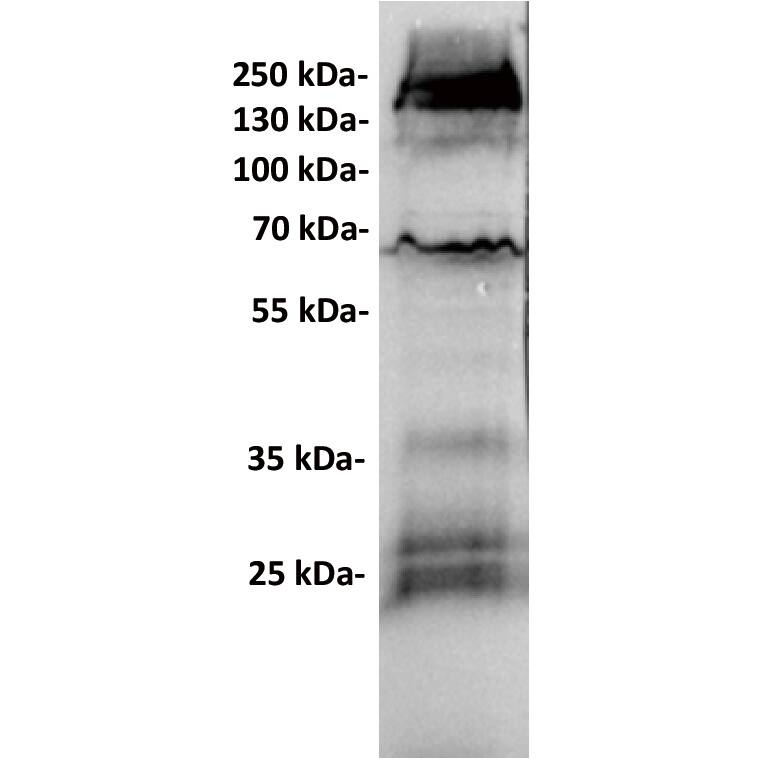 GUCY2C Antibody (6E3) - Chimeric