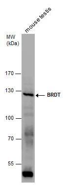 BRDT Antibody
