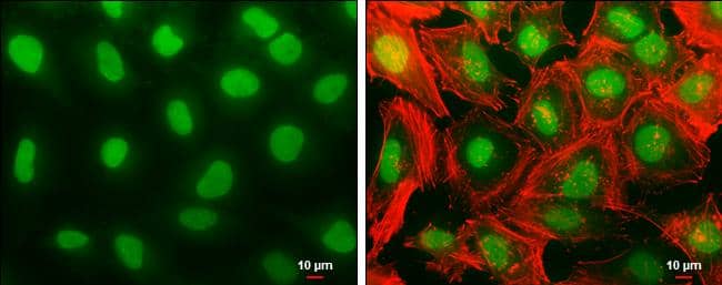 Histone H1.3 Antibody