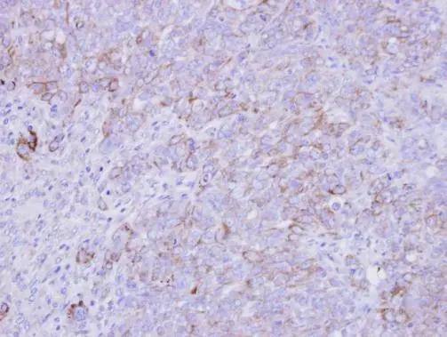 SLC26A8 Antibody