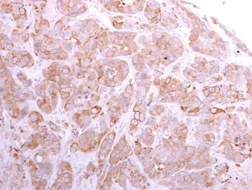 SLC26A8 Antibody