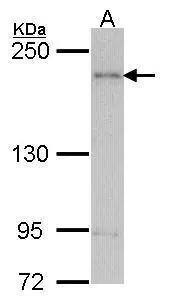 ARAP1 Antibody