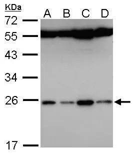 FAM9B Antibody