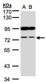 FSD2 Antibody