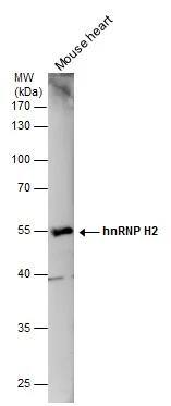 hnRNP H2 Antibody