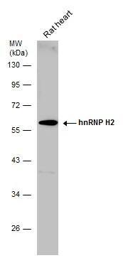 hnRNP H2 Antibody