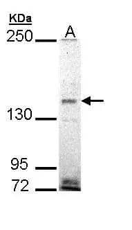 EHBP1 Antibody