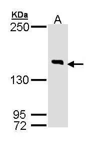 DIP2B Antibody