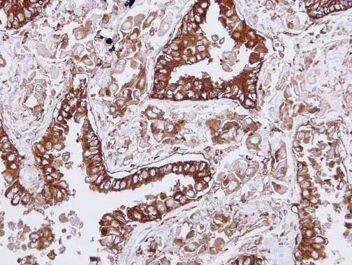HLA DQB1 Antibody