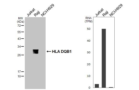 HLA DQB1 Antibody