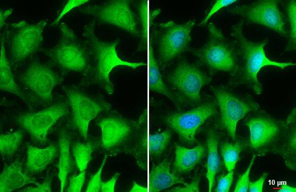 Puromycin-sensitive aminopeptidase/NPEPPS Antibody