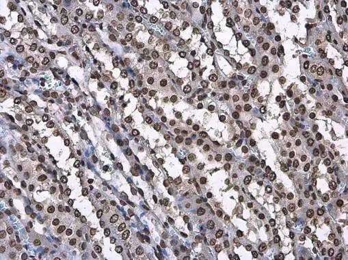 Histone H3.3B Antibody