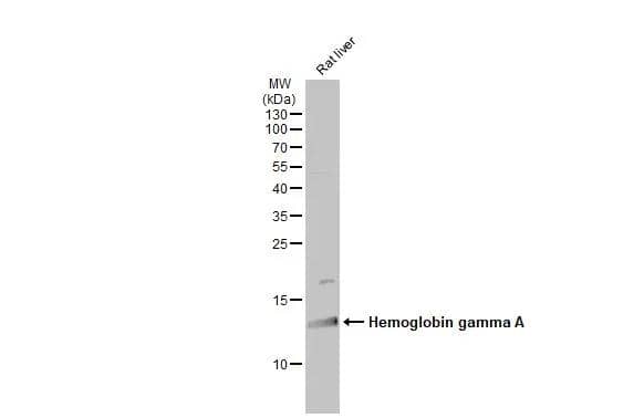 Fetal Hemoglobin Antibody