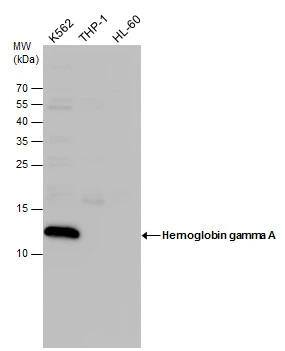 Fetal Hemoglobin Antibody