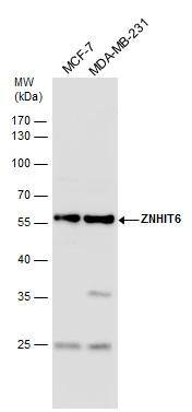 ZNHIT6 Antibody