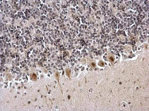 ZNF545 Antibody