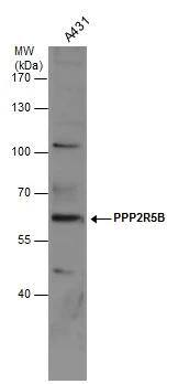 PPP2R5B Antibody