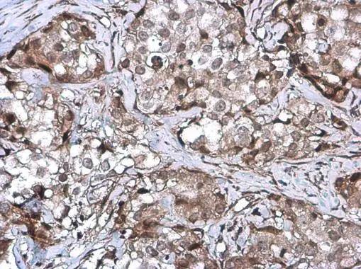 ZNF599 Antibody
