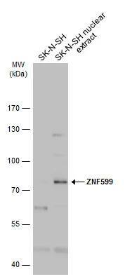 ZNF599 Antibody