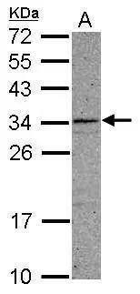 CCDC107 Antibody