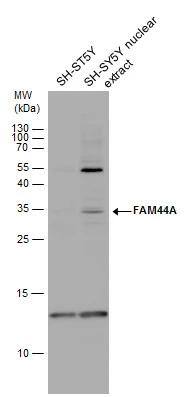 BOD1L Antibody