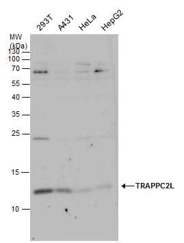 TRAPPC2L Antibody