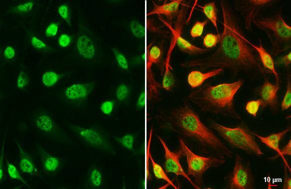 SETDB1 Antibody (HL3260)