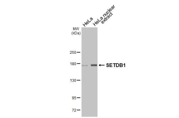 SETDB1 Antibody (HL3260)