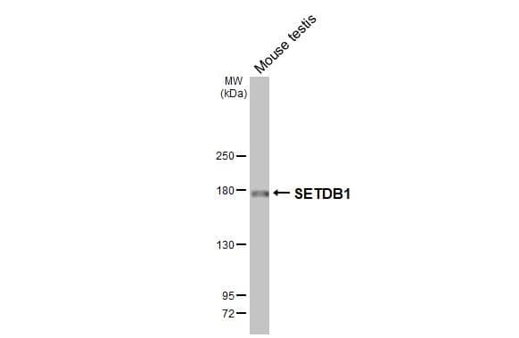 SETDB1 Antibody (HL3260)