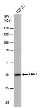 AAR2 Antibody