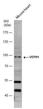 VEPH1 Antibody