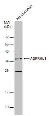 ADPRHL1 Antibody