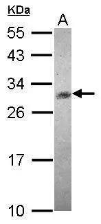 CHAC1 Antibody