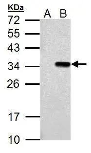 T7 Epitope Tag Antibody