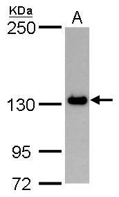 PPP1R3A Antibody