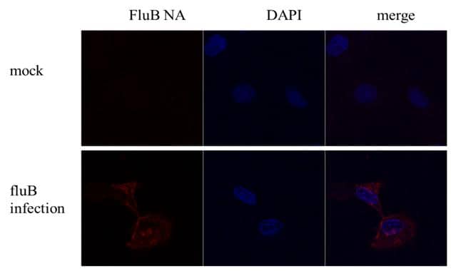 Influenza B Virus Neuraminidase Antibody