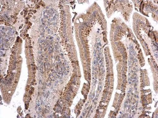 ATOH7 Antibody