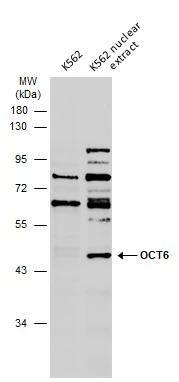 OCT6 Antibody
